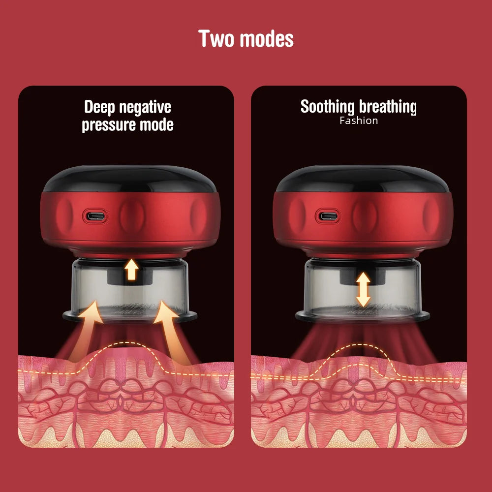 Electric Vacuum Cupping